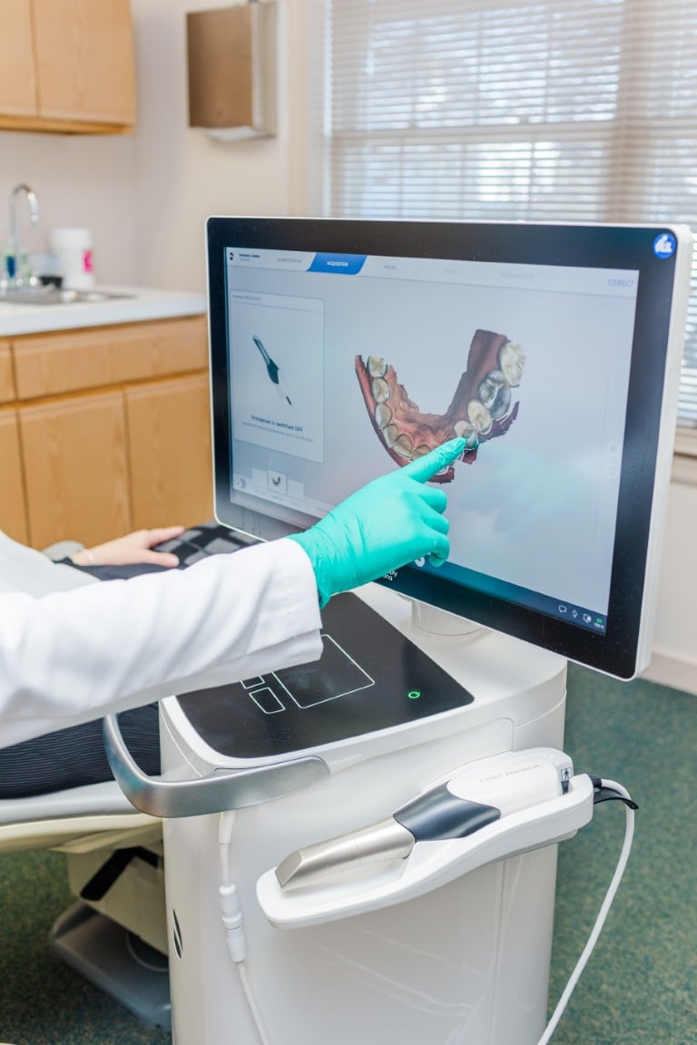 Same Day Crowns in Ashland Scanner