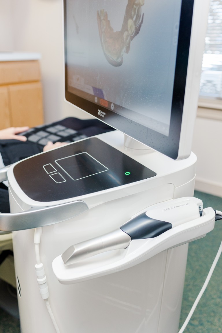 Scanner technology