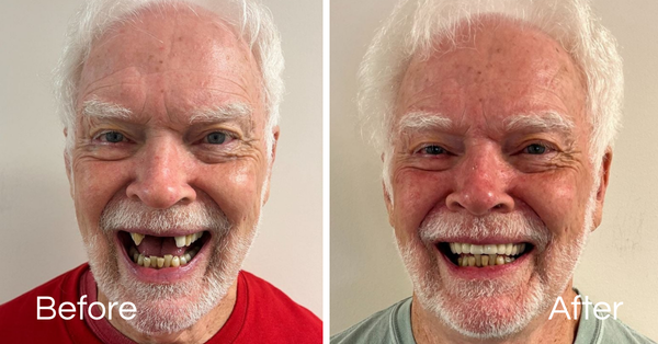 Before And Afters Smile Makeover