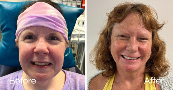 Before And Afters Smile Makeover
