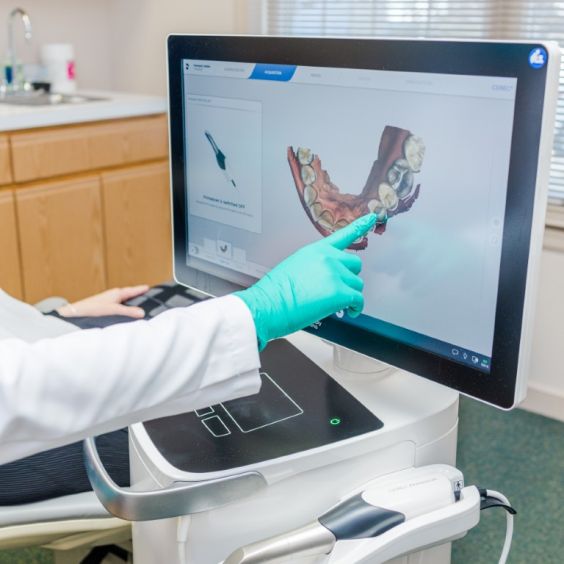 Same Day Crowns in Ashland Scanner